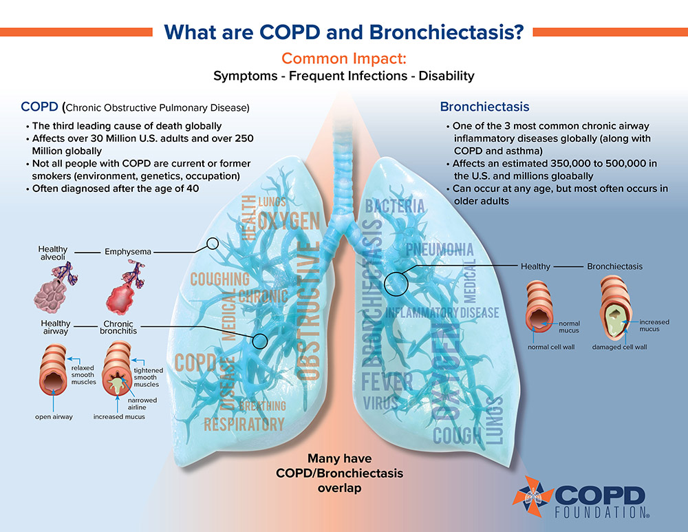 Bronchiectasis and COPD