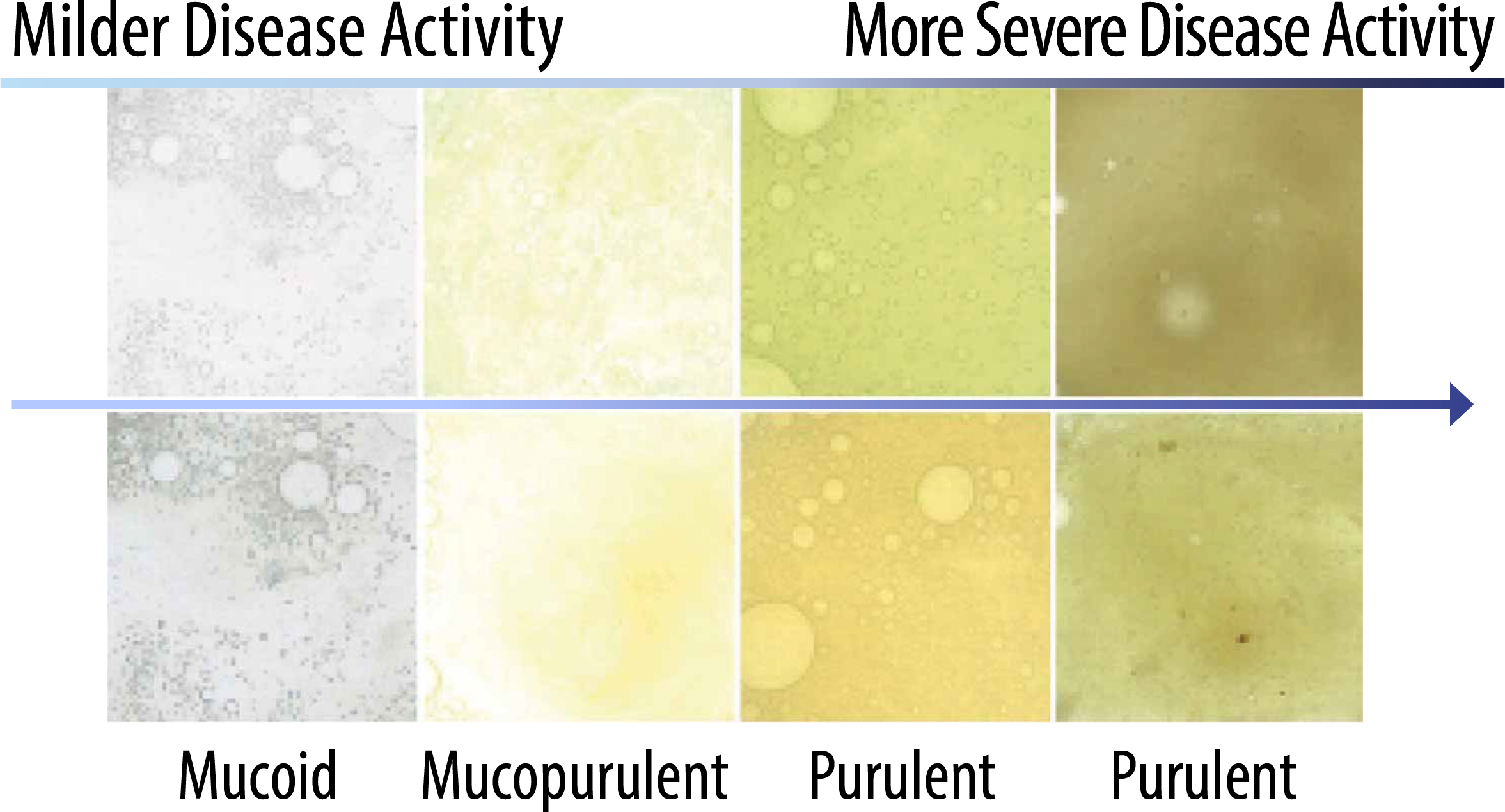 SputumColorChart
